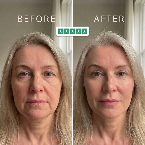 Emma, 56